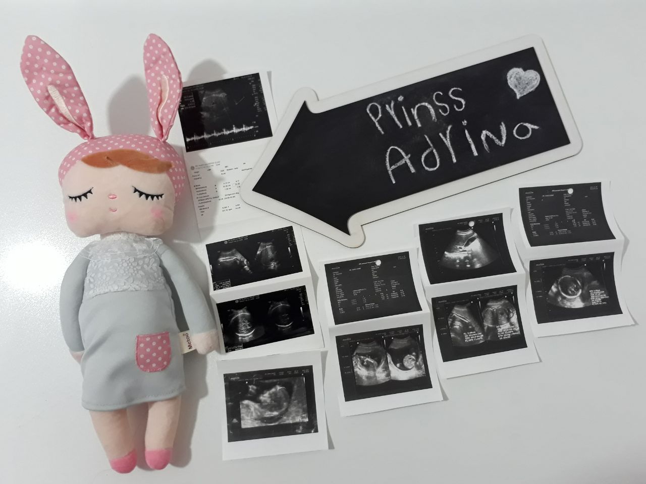 متولد شدن نوزاد هیراد پورعسگری