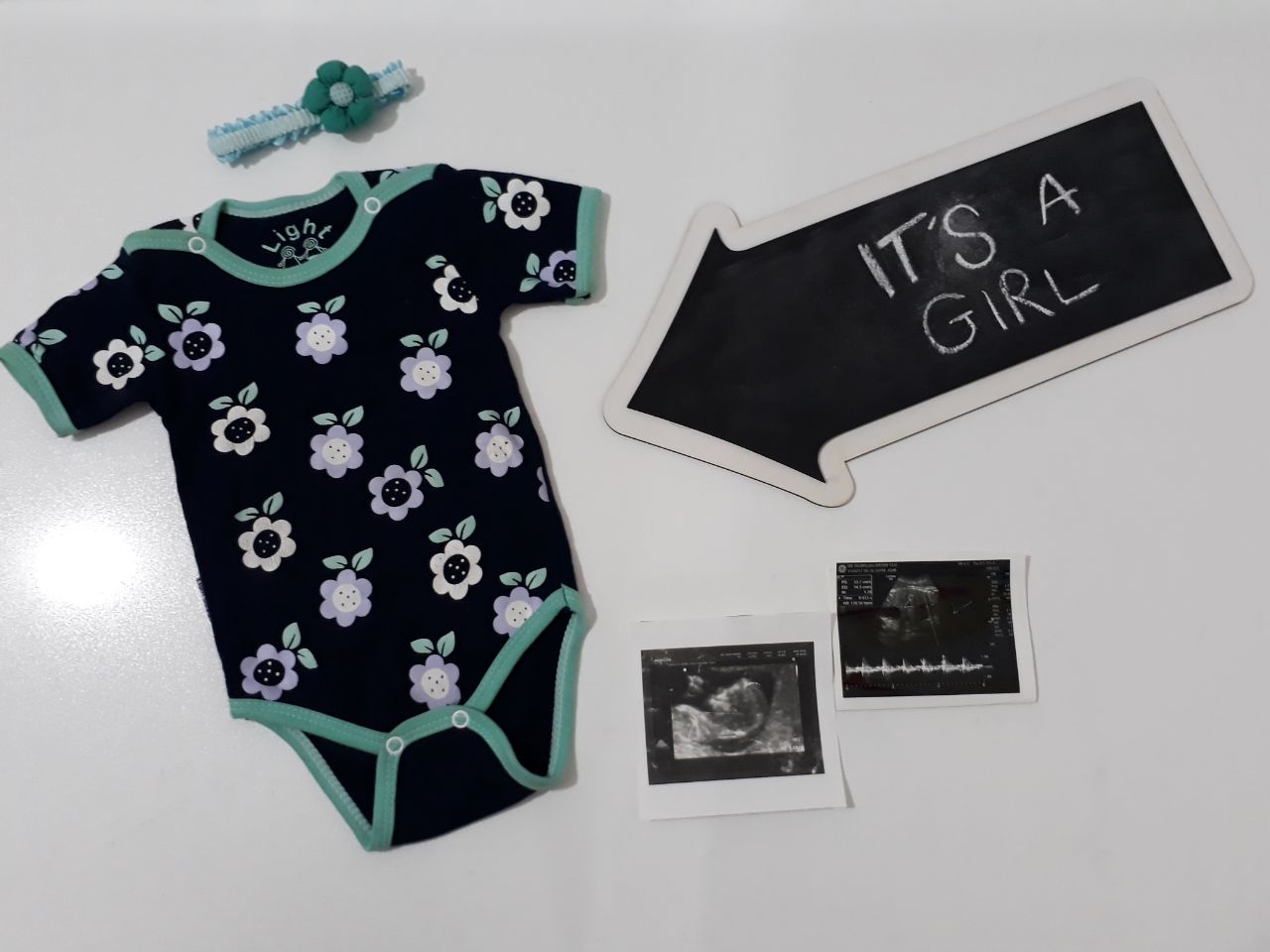 عکس نوزاد دختر هیراد پورعسگری