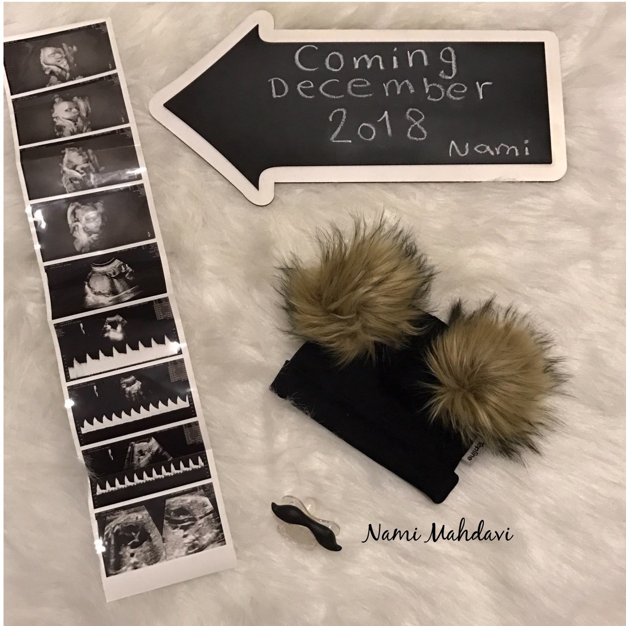 ژست عکس بارداری هیراد پورعسگری