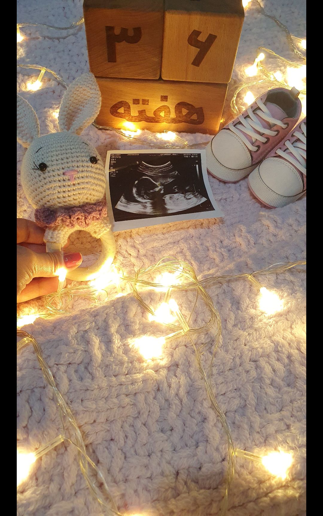 بارداری رادین و آیلین اسکندرزاده