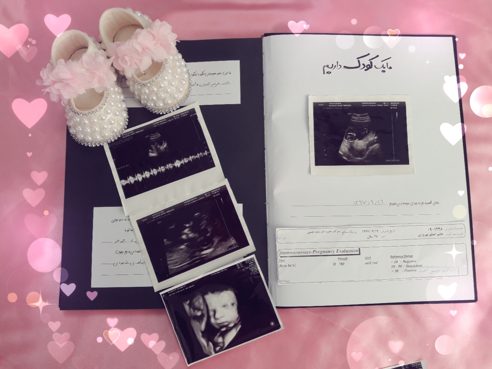 آلبوم خاطرات کودکی سلین