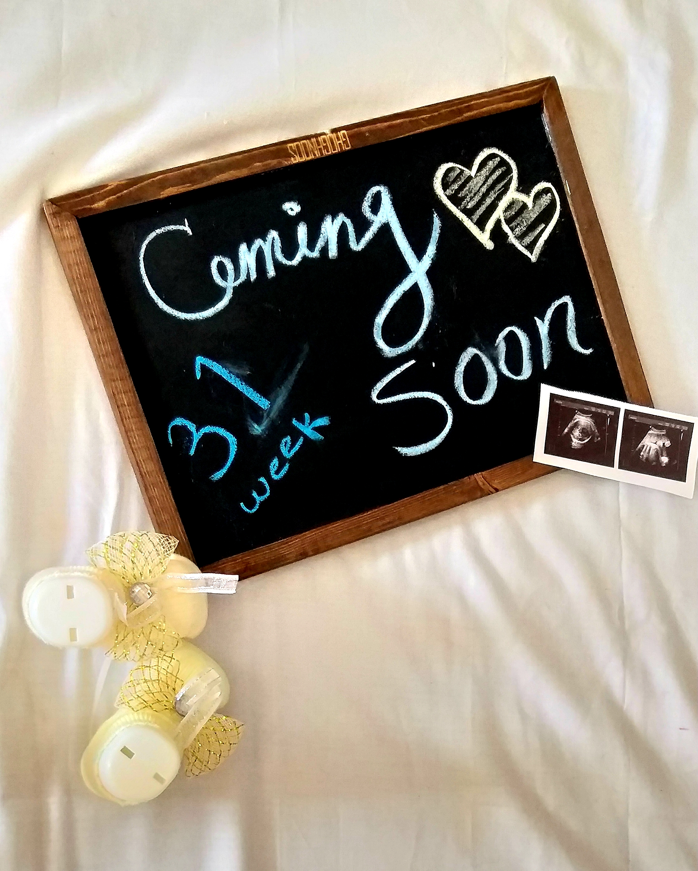 ژست عکس بارداری بهارناز غریبی