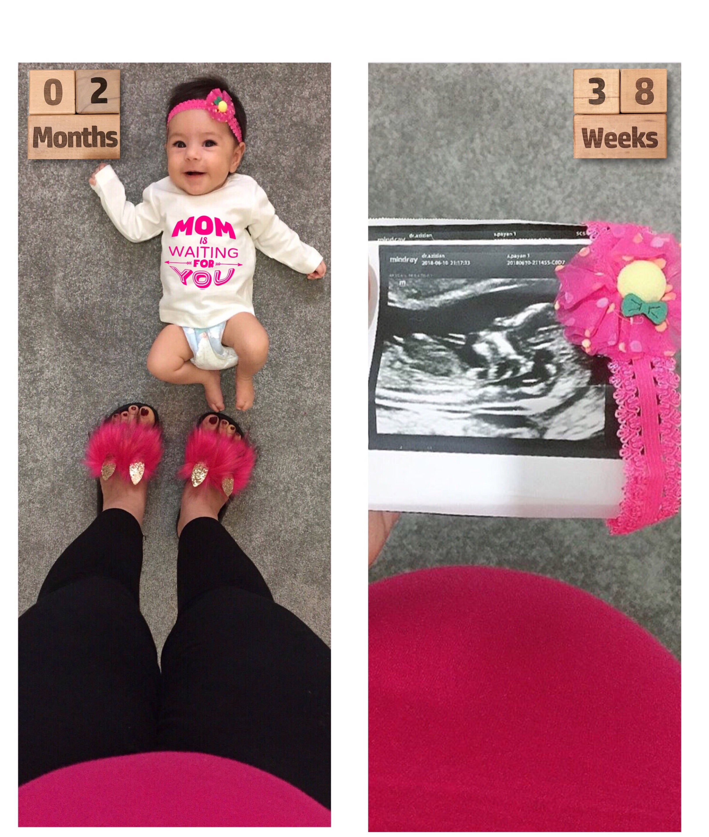 دو ماهگی نوزاد ليانا خسروي