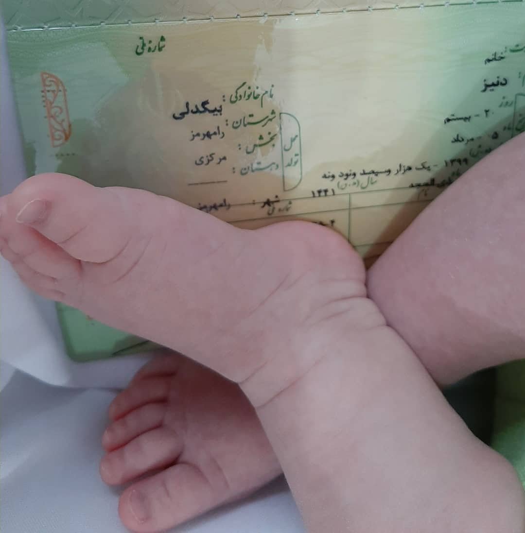 آلبوم خاطرات کودکی دنیز  بیگدلی