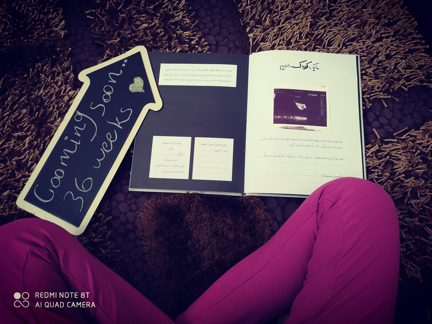 آلبوم خاطرات کودکی دلوین سالاری