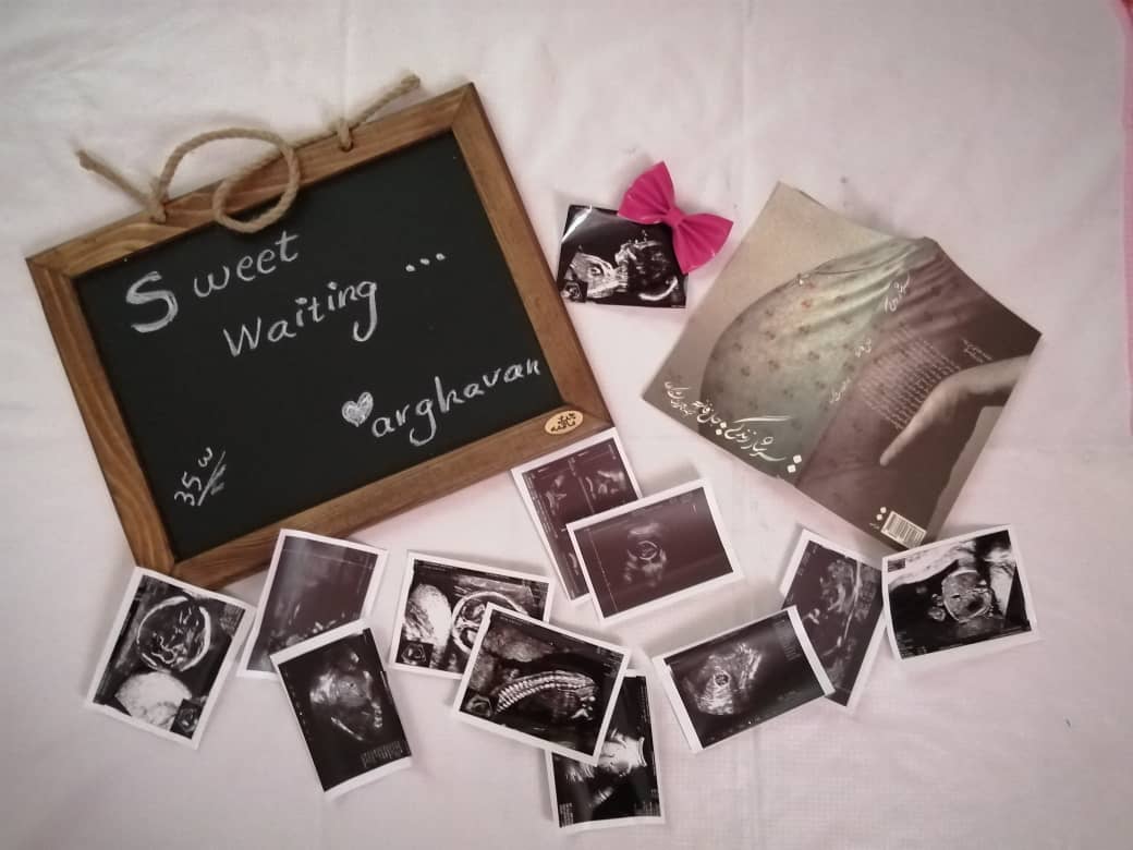 بارداری ارغوان عبداله زاده