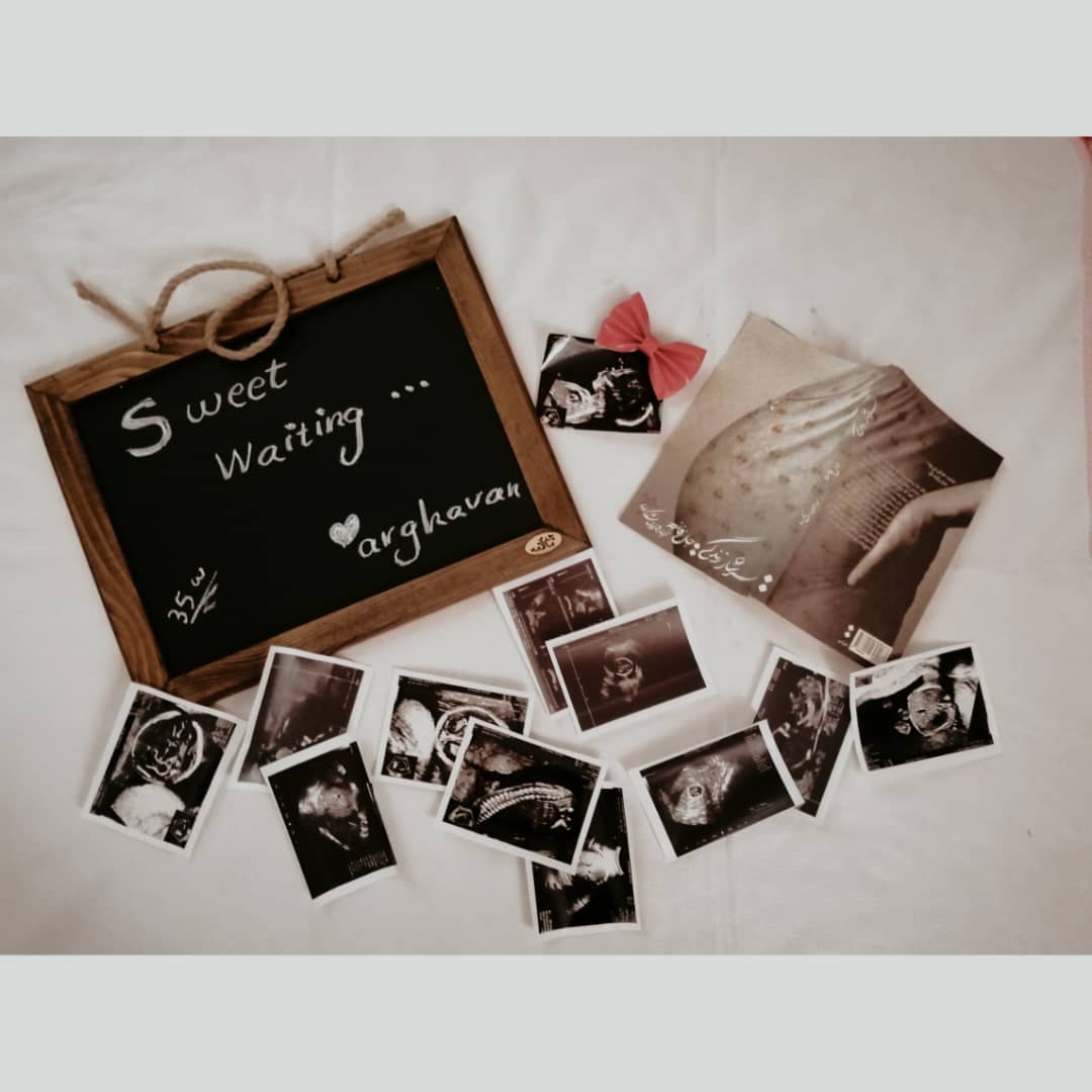 بارداری ارغوان عبداله زاده