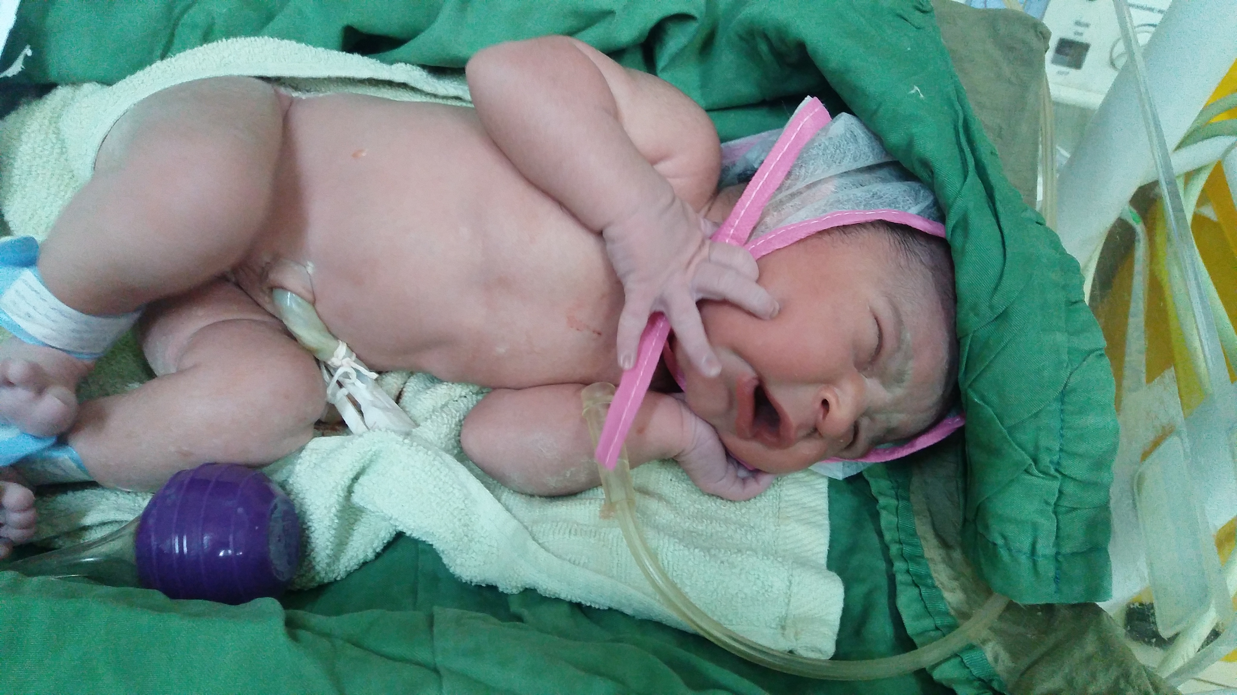 عکس نوزاد دختر السا علیزاده