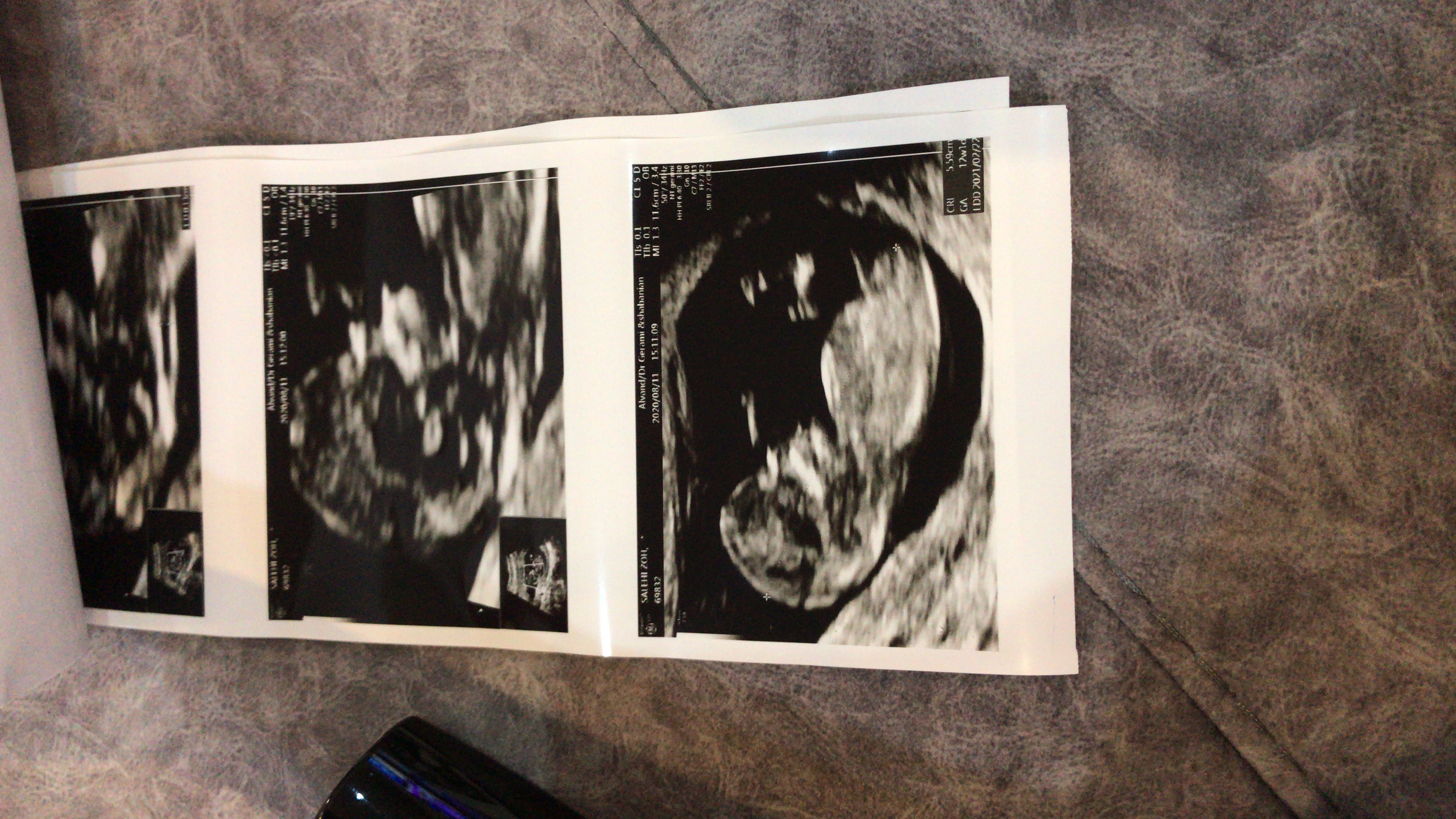 بارداری ليام جوزا