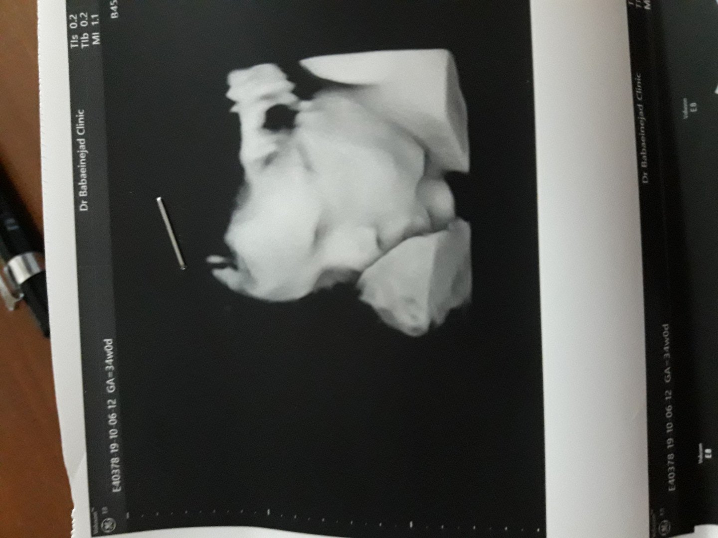 یازده ماهگی نوزاد امیرعلی خشنودی