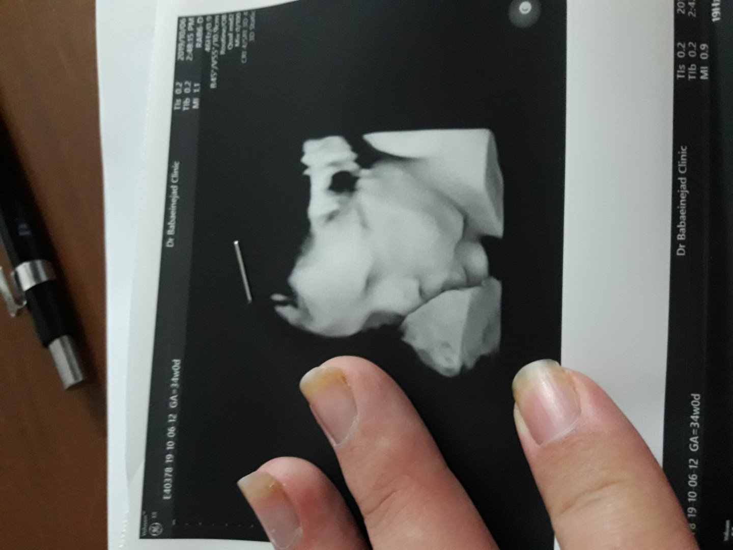 یازده ماهگی نوزاد امیرعلی خشنودی