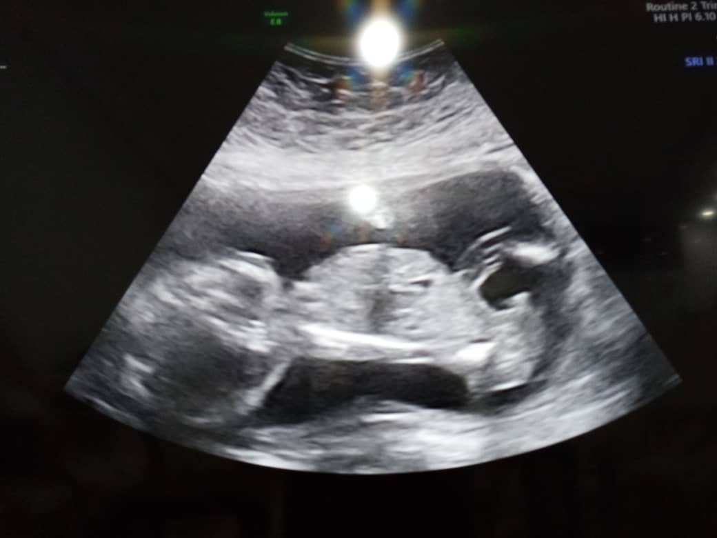 ماه پنجم بارداری امیر علی چوگان باز