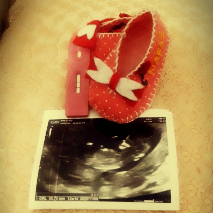 بارداری نفس میرزایی