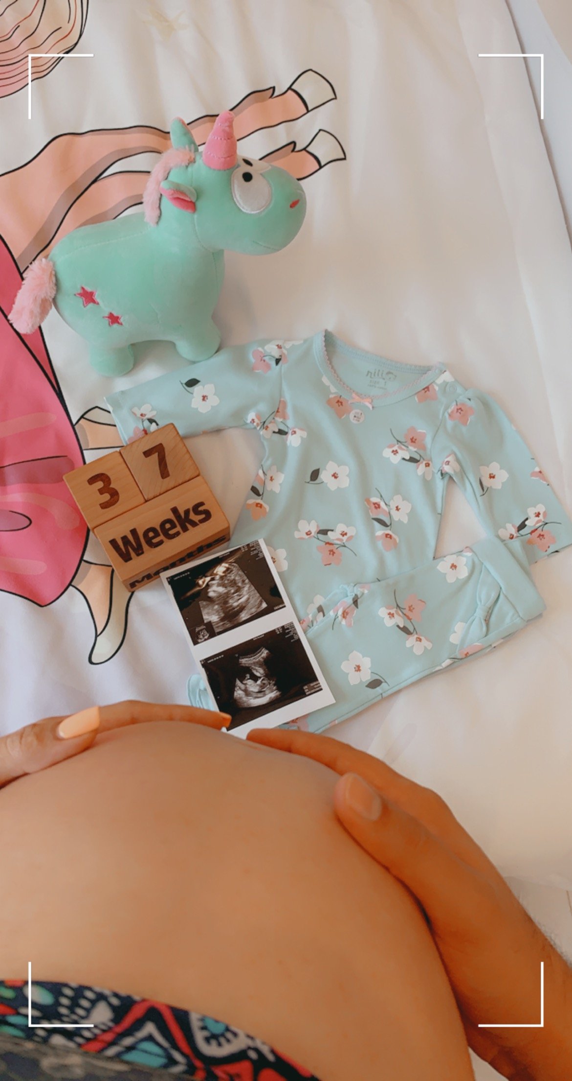 بارداری غزاله جوان