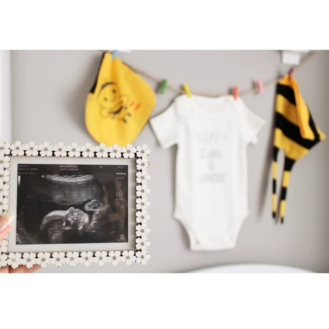 بارداری امین آقا محمدی