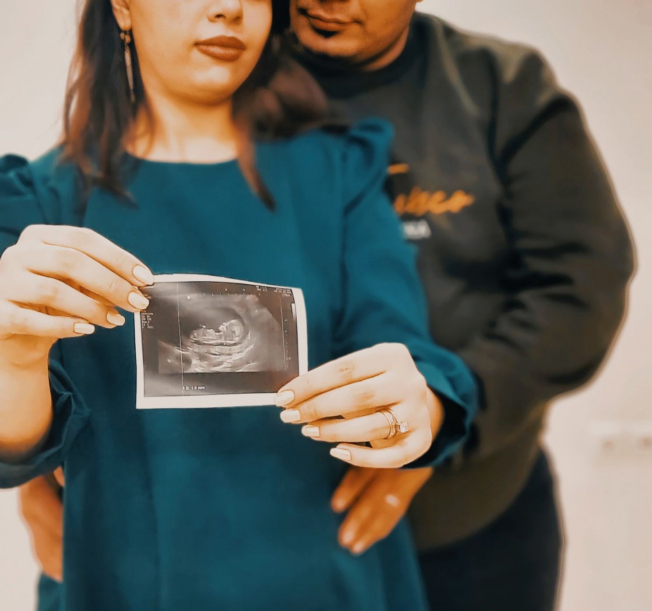 جشن تعیین جنسیت کارن مهدوی