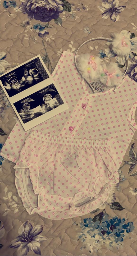 بارداری آیه چلوئیان