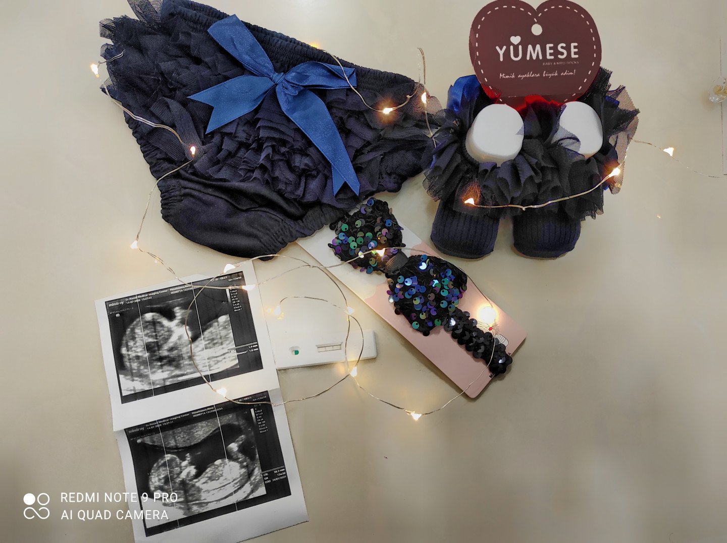 بارداری آیسا قریشی