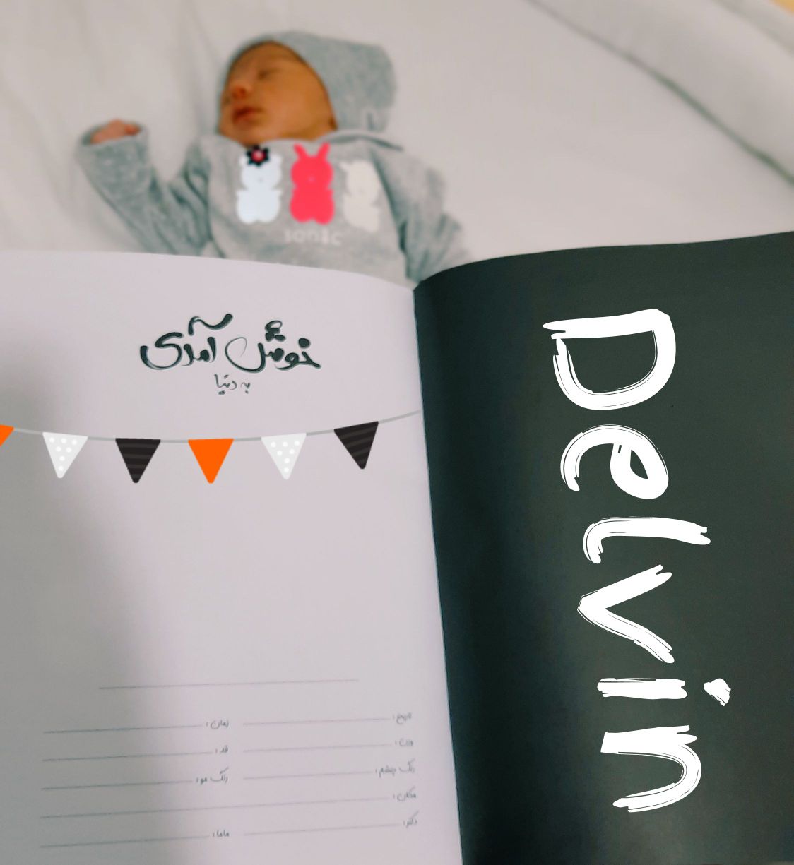 متولد شدن نوزاد delvin