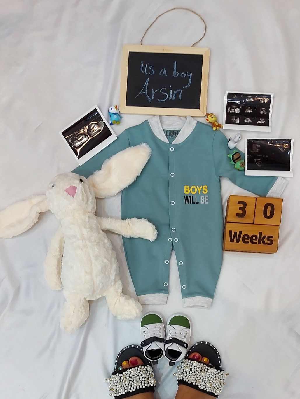 بارداری آرسین