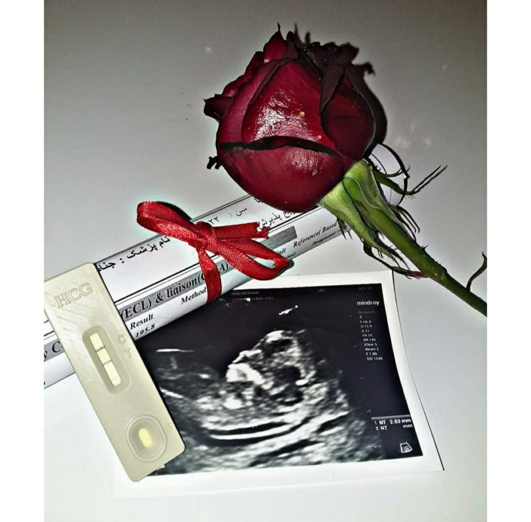 بارداری طاها ناظمی فر