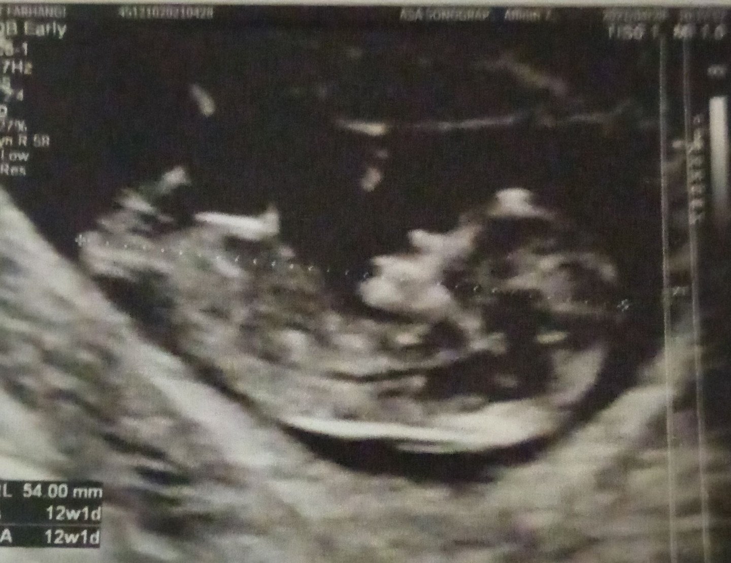 بارداری ملودی فهیمی