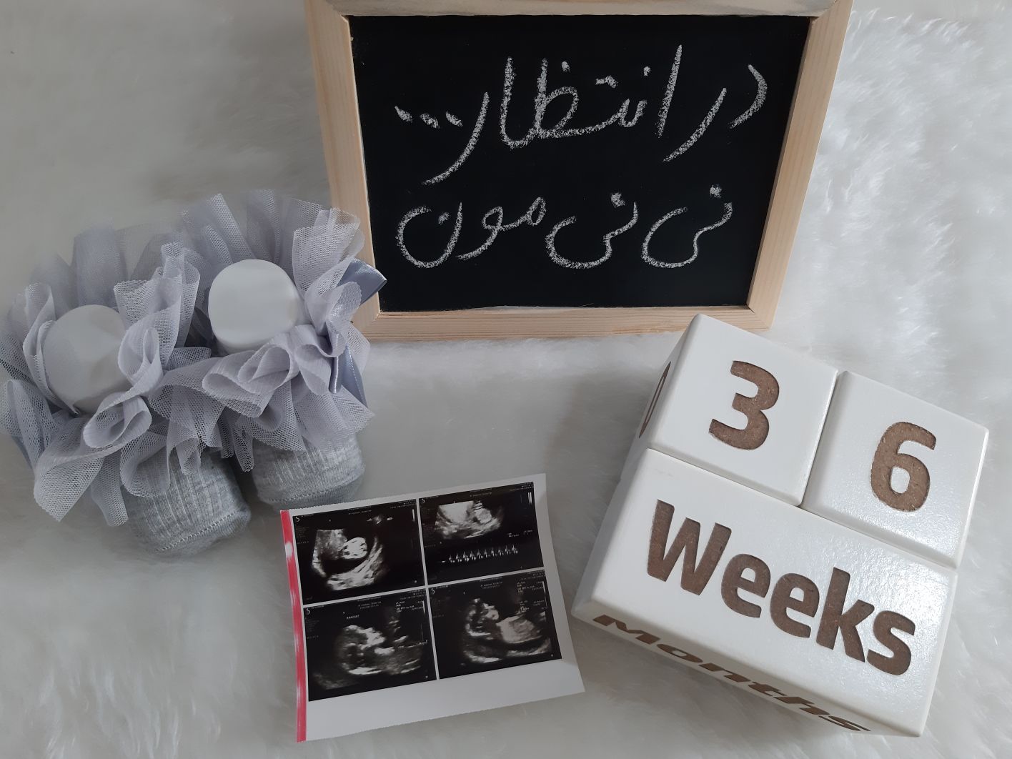 بارداری Amirreza khazaei