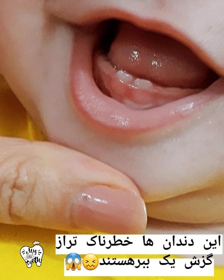 دختر پناه شاخص