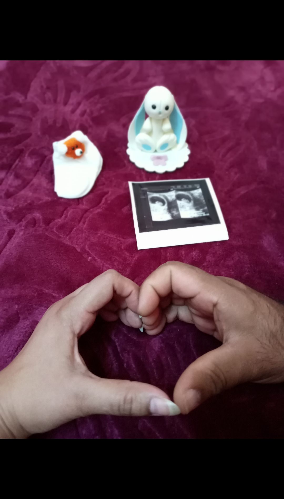 دوماهگی-بارداری برسام سیفی کناری