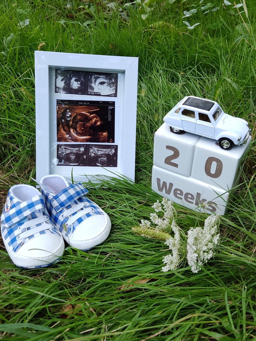 عکس نوزاد پسر محمد علی بک زاده