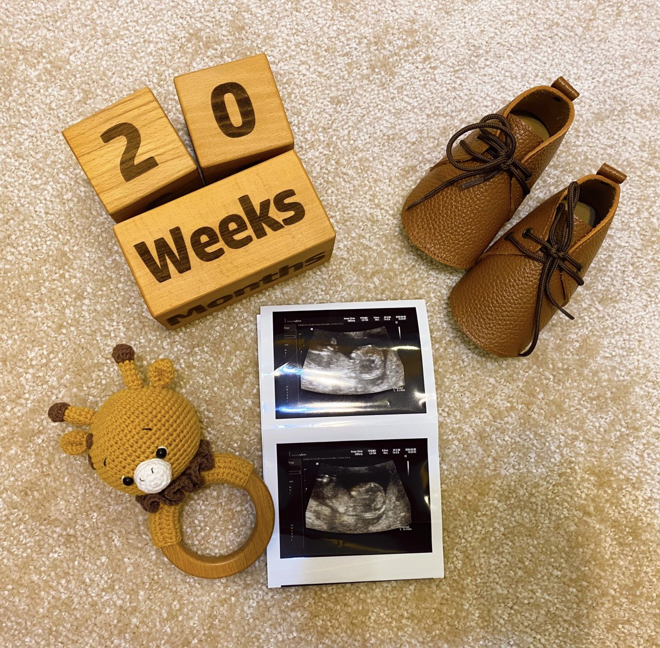 بارداری سامیار کریمی