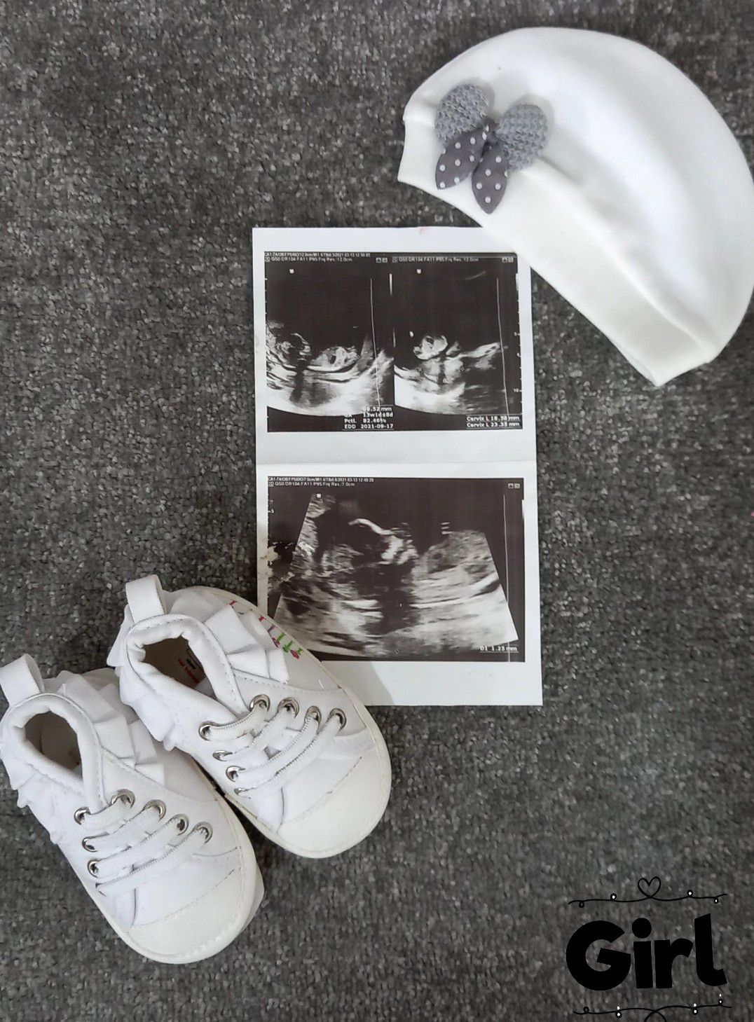 بارداری Mohna Babaloei