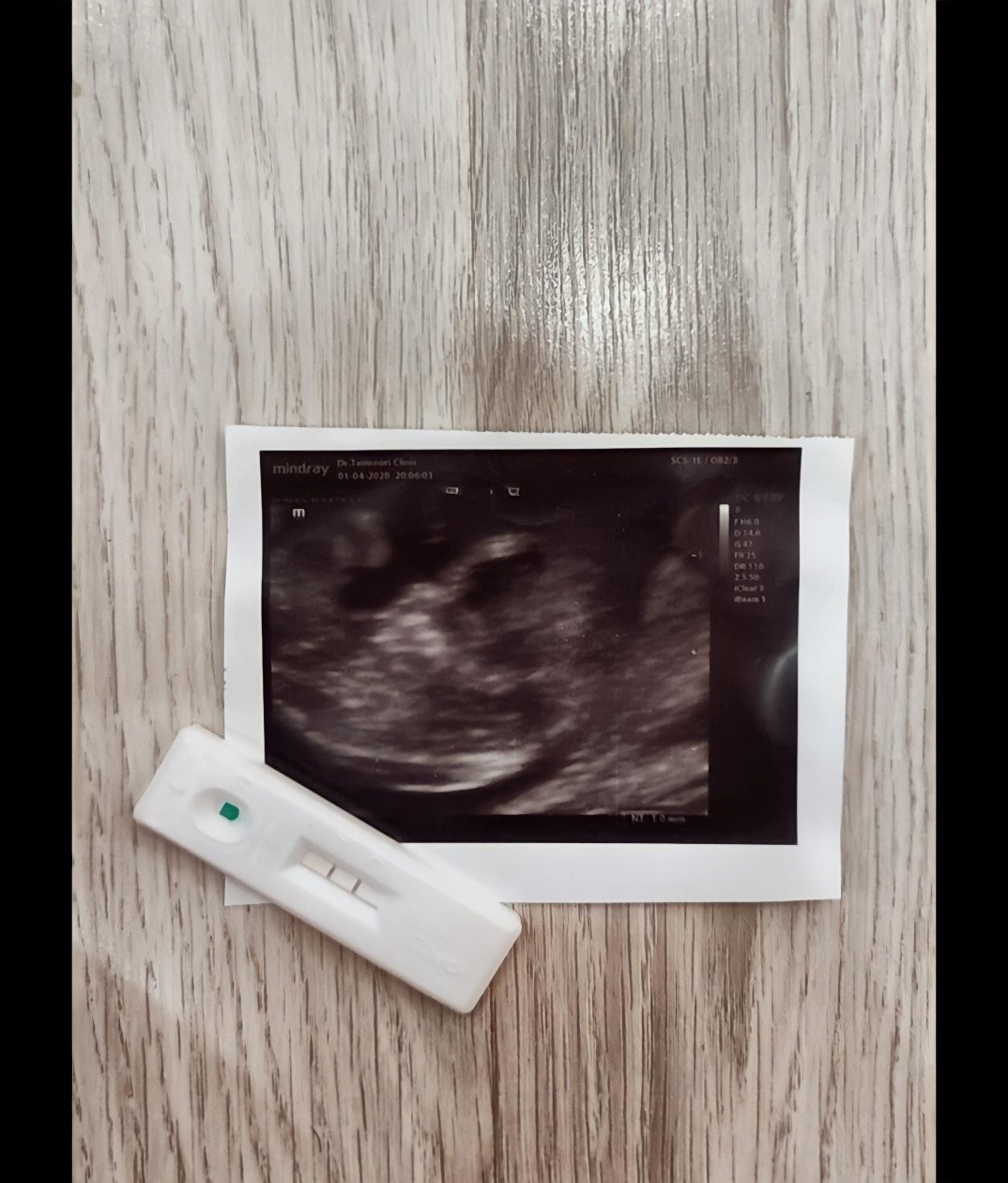 بارداری شاهان