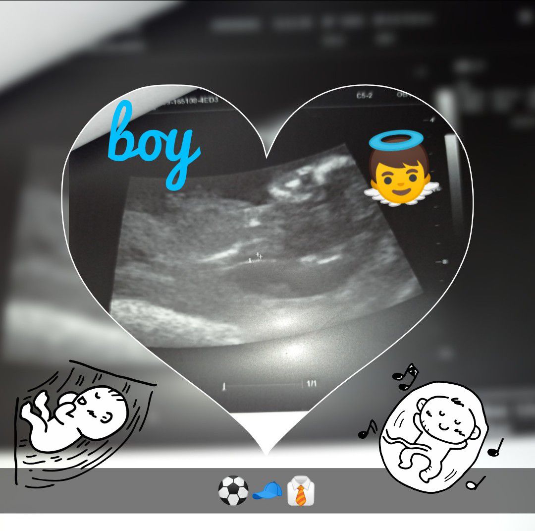 بارداری امیرعلی عارفی