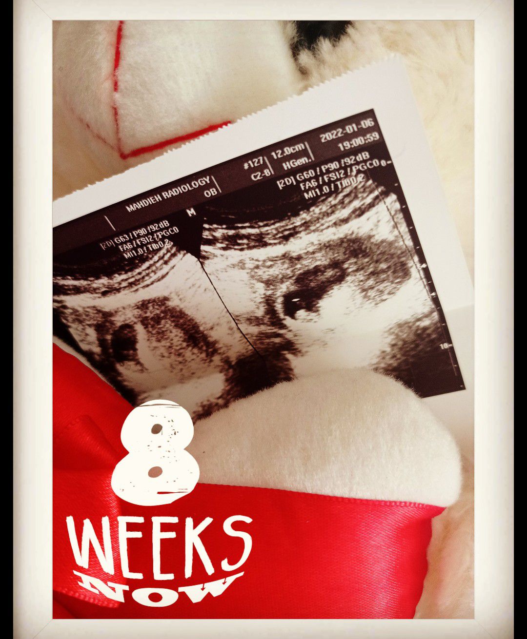 دوماهگی-بارداری امیرعلی عارفی