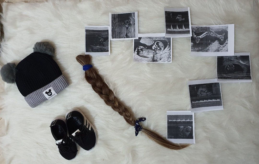 سونوگرافی آیکان