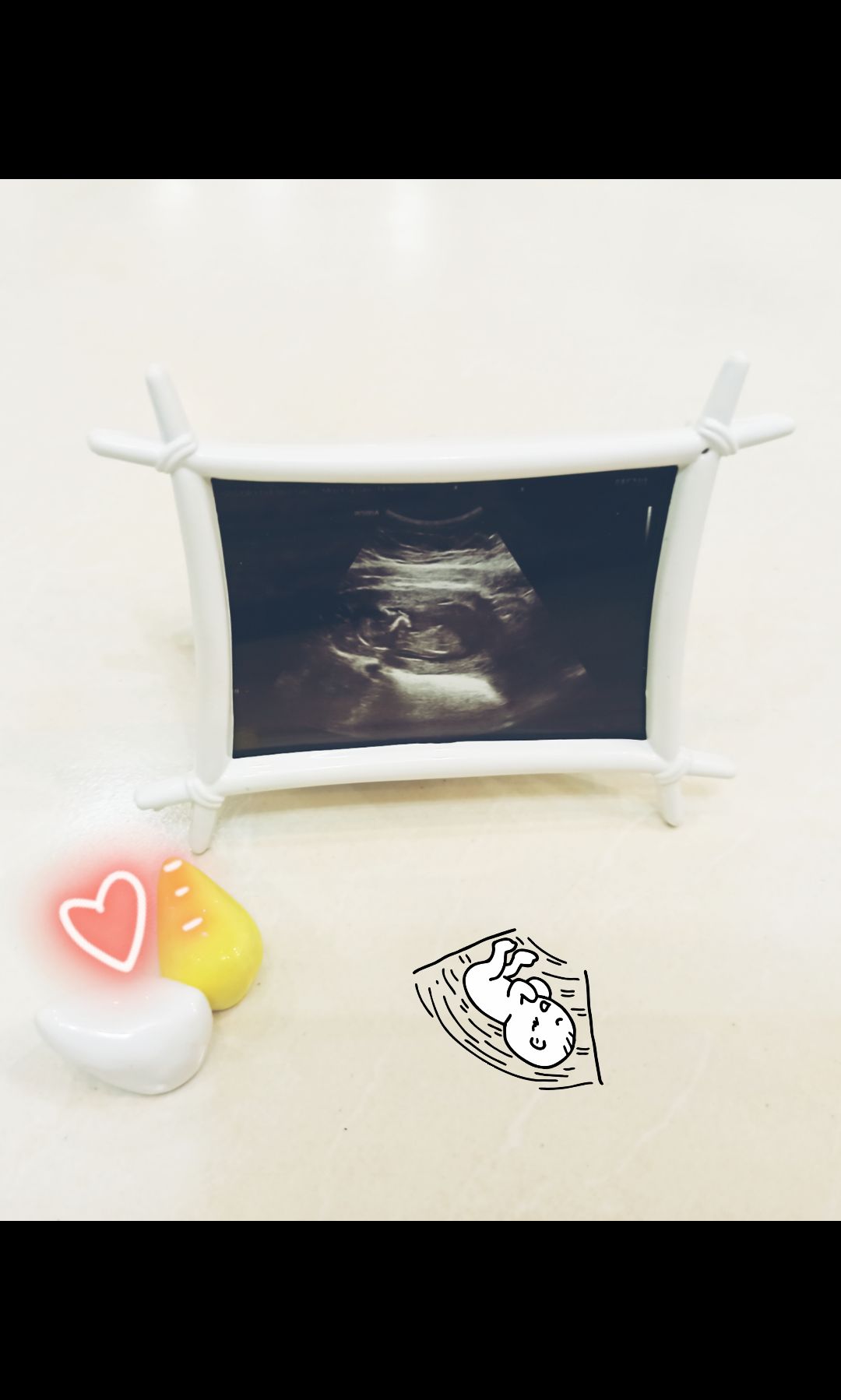 بارداری نلا آجورلو