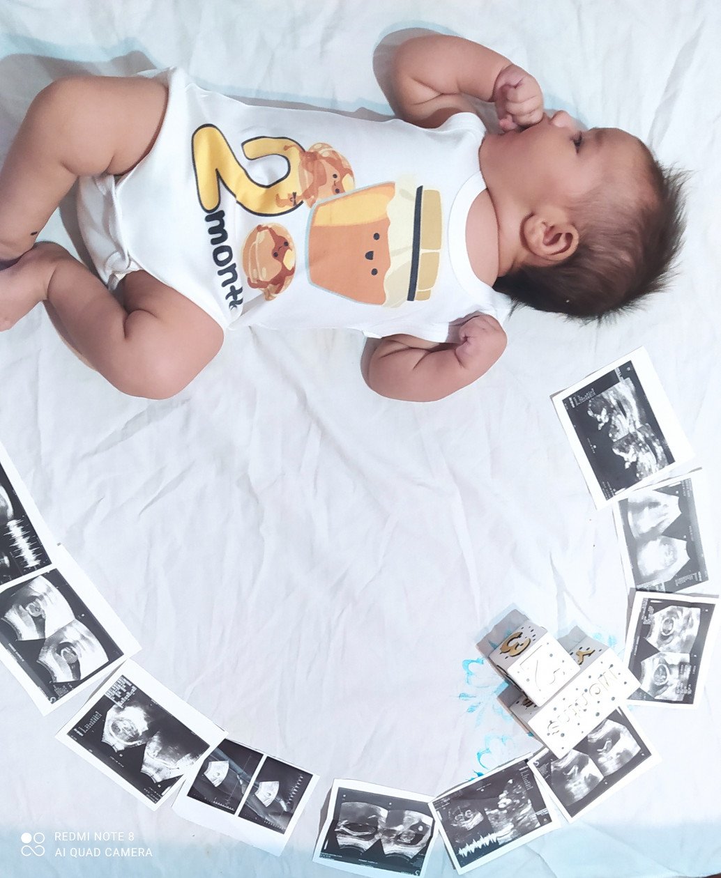 اولین خنده نوزاد همتایزدانی