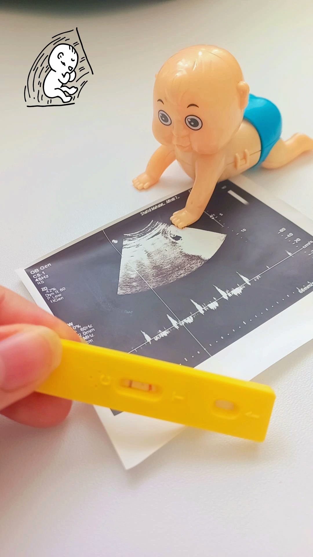 بارداری آکای خجسته