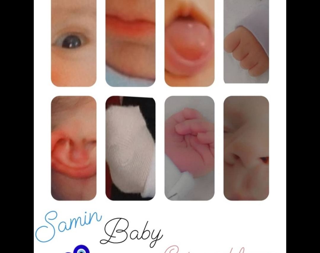 اجزای-صورت سامین آزاد