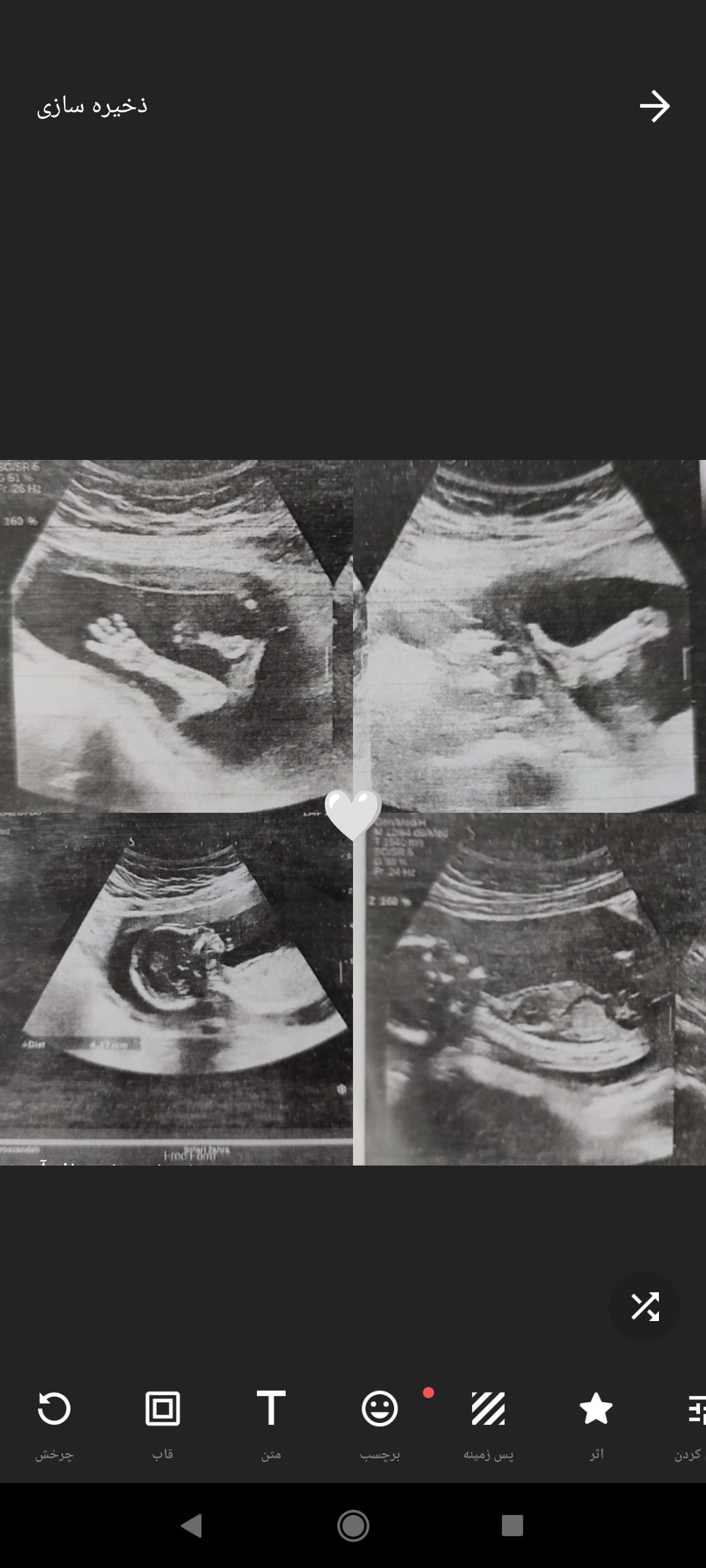 بارداری زهرا صفری