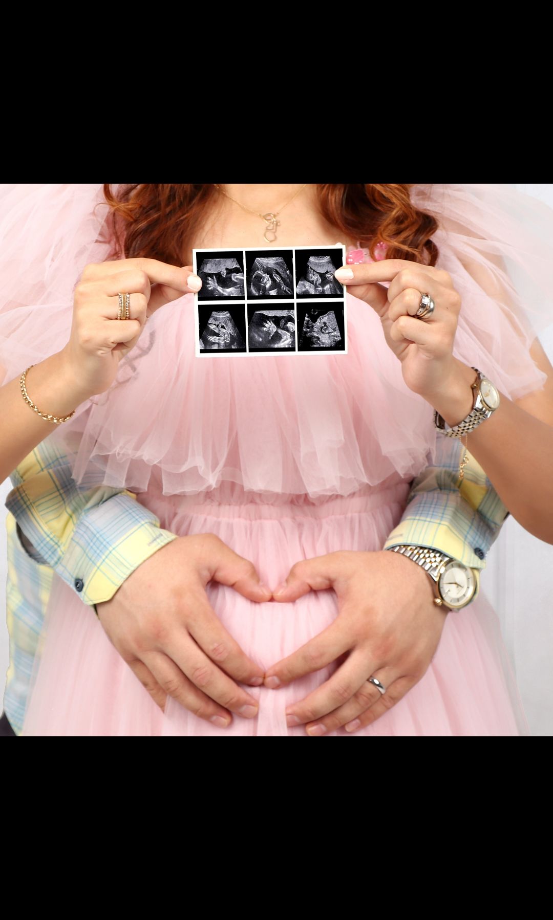 بارداری Vin❤