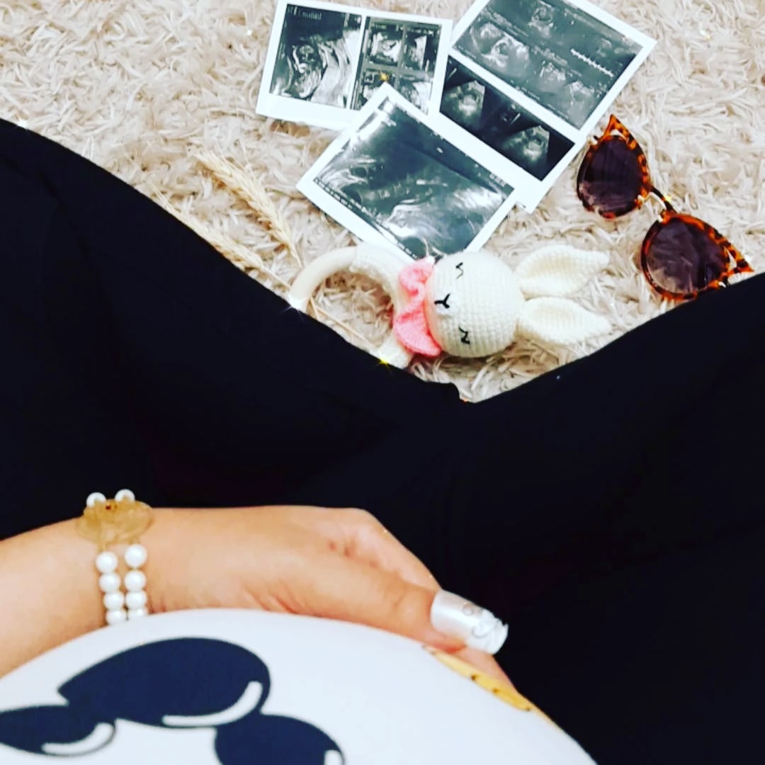 بارداری بانو مهرآیین دهقانپور فراشاه