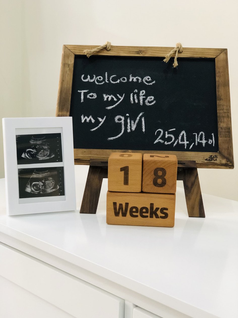 تخته سیاه فانتزی روشا رشمه ای