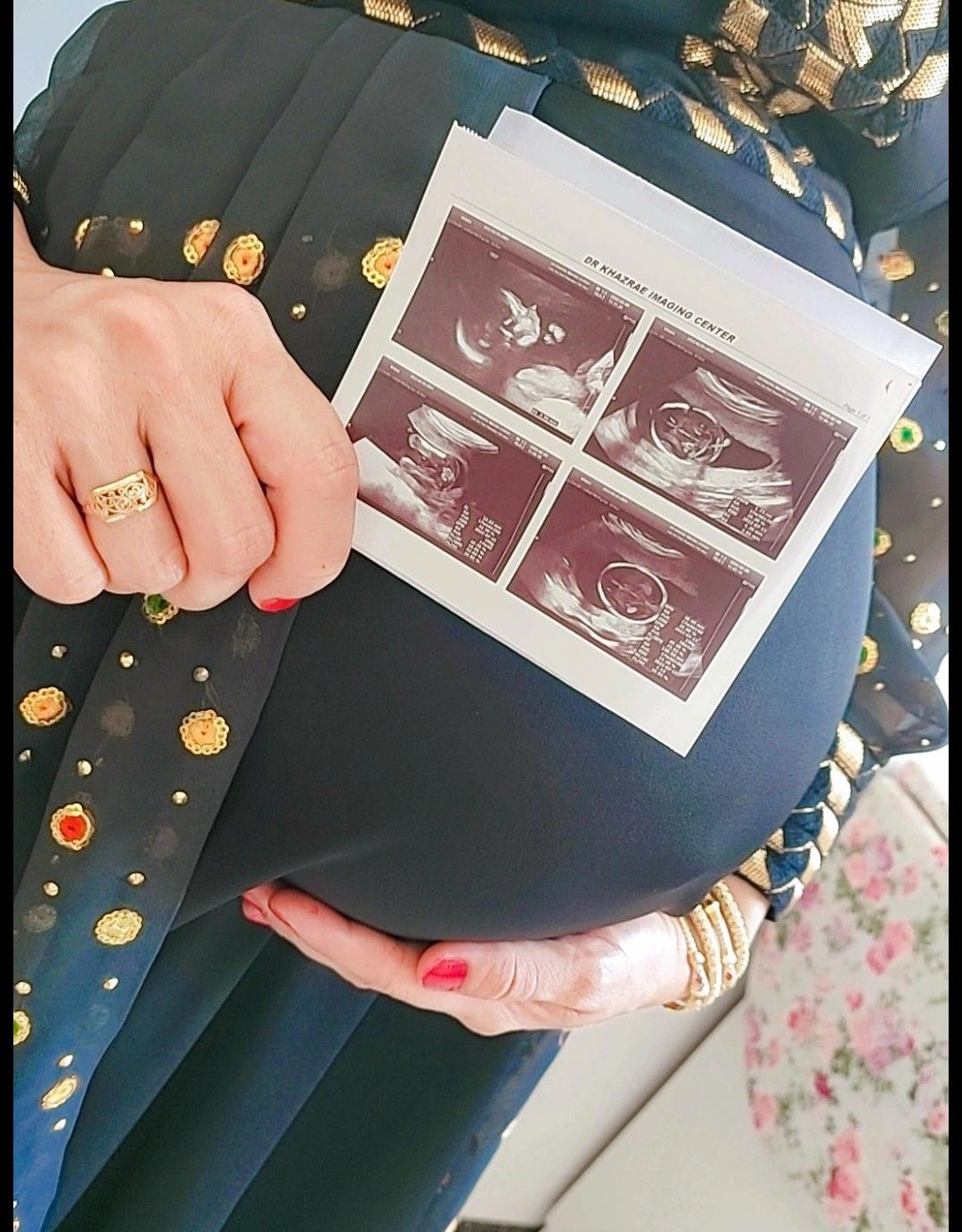 بارداری میران اقتداری