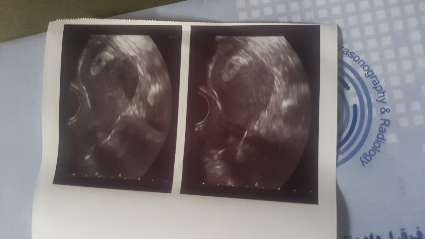 بارداری مریم جمشیدیان