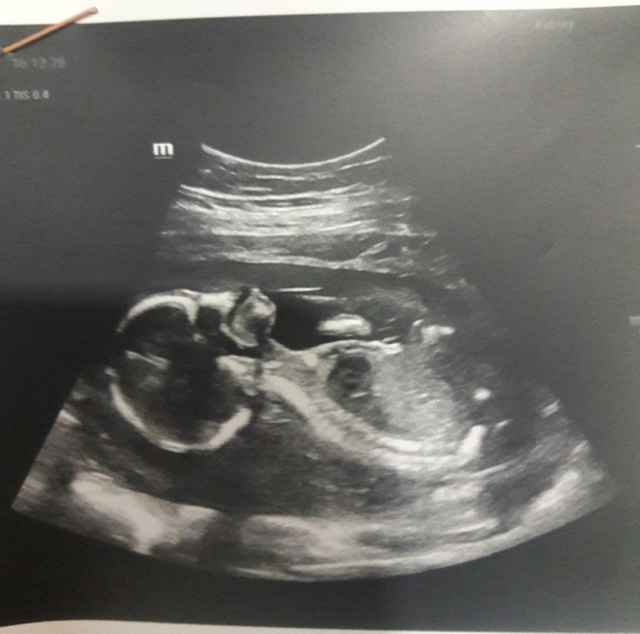 یازده ماهگی نوزاد الین پوراحمد جوبنی